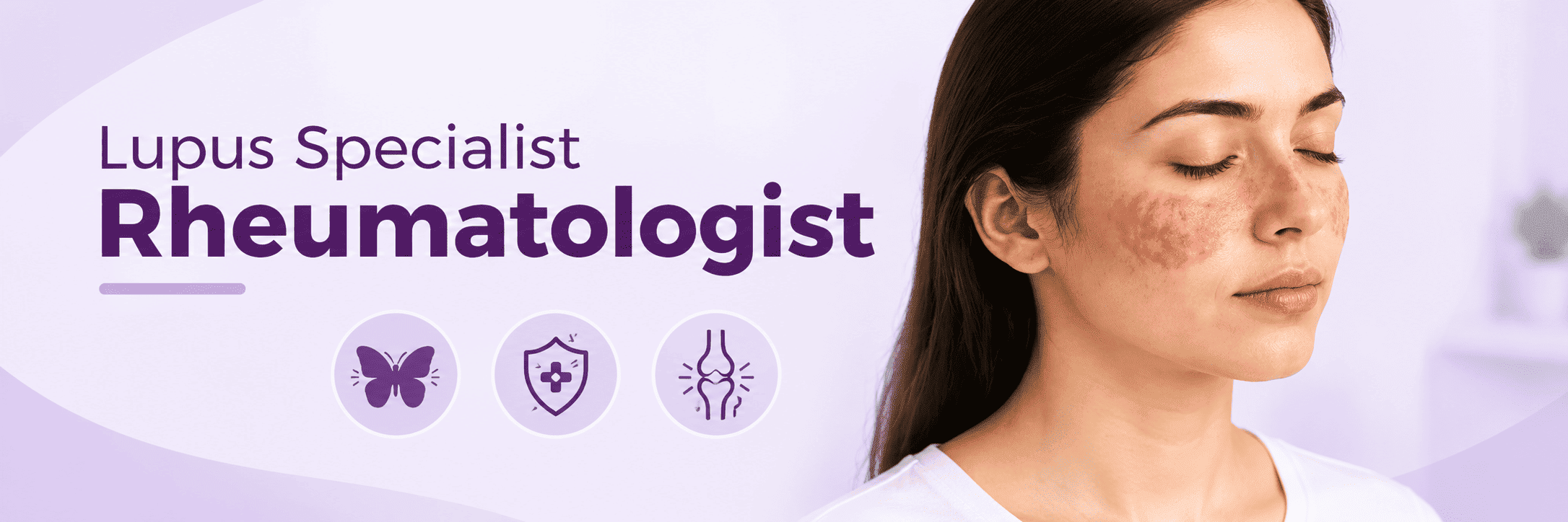 lupus specialist rheumatologist in mumbai